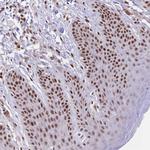 NFIC Antibody in Immunohistochemistry (Paraffin) (IHC (P))