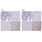 ATP4B Polyclonal Antibody