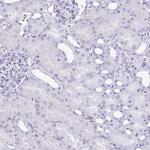 ATP4B Antibody in Immunohistochemistry (Paraffin) (IHC (P))