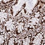 hnRNP L Antibody in Immunohistochemistry (Paraffin) (IHC (P))