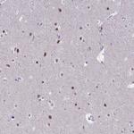 MLH1 Antibody in Immunohistochemistry (Paraffin) (IHC (P))