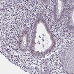 MLH1 Antibody in Immunohistochemistry (Paraffin) (IHC (P))