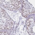 MLH1 Antibody in Immunohistochemistry (Paraffin) (IHC (P))