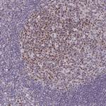 MLH1 Antibody in Immunohistochemistry (Paraffin) (IHC (P))