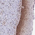 TRIP6 Antibody in Immunohistochemistry (Paraffin) (IHC (P))