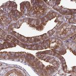 TRIP6 Antibody in Immunohistochemistry (Paraffin) (IHC (P))