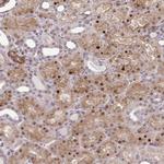TRIP6 Antibody in Immunohistochemistry (Paraffin) (IHC (P))