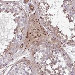TRIP6 Antibody in Immunohistochemistry (Paraffin) (IHC (P))