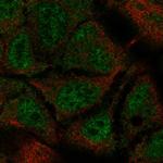 C11orf20 Polyclonal Antibody