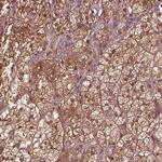 ASCC2 Polyclonal Antibody