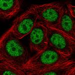 SAP30BP Polyclonal Antibody