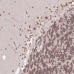 SAP30BP Antibody in Immunohistochemistry (Paraffin) (IHC (P))