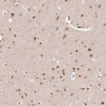SAP30BP Antibody in Immunohistochemistry (Paraffin) (IHC (P))