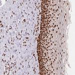 SAP30BP Antibody in Immunohistochemistry (Paraffin) (IHC (P))