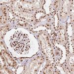 SAP30BP Antibody in Immunohistochemistry (Paraffin) (IHC (P))