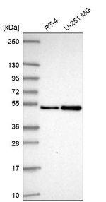 SAP30BP Antibody in Western Blot (WB)