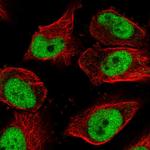 GMEB1 Polyclonal Antibody