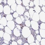 TSPEAR Polyclonal Antibody