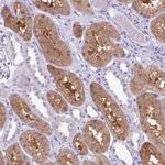 MDS2 Polyclonal Antibody