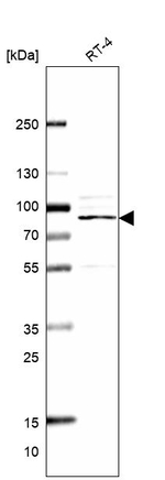 ITPKC Antibody in Western Blot (WB)