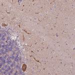 L3MBTL3 Antibody in Immunohistochemistry (Paraffin) (IHC (P))