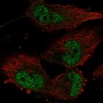 TATDN1 Polyclonal Antibody