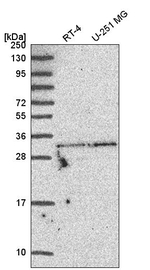 TATDN1 Antibody in Western Blot (WB)