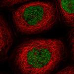 EXO1 Polyclonal Antibody