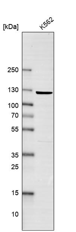 EXO1 Antibody in Western Blot (WB)