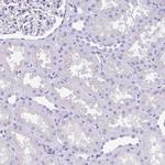 Amylin Polyclonal Antibody