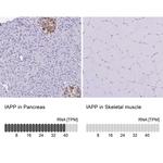 Amylin Antibody