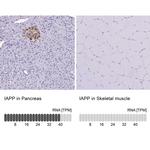 Amylin Antibody