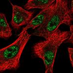 DOCK1 Polyclonal Antibody