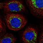 NDUFB6 Polyclonal Antibody