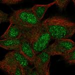 KIAA0408 Antibody in Immunocytochemistry (ICC/IF)