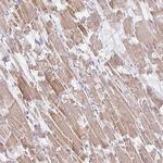 PLA2G5 Antibody in Immunohistochemistry (Paraffin) (IHC (P))