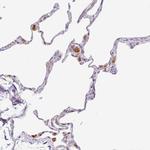 PLA2G5 Antibody in Immunohistochemistry (Paraffin) (IHC (P))