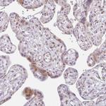 PLA2G5 Polyclonal Antibody