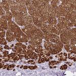 CYP21A2 Antibody in Immunohistochemistry (Paraffin) (IHC (P))