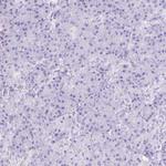 CYP21A2 Antibody in Immunohistochemistry (Paraffin) (IHC (P))