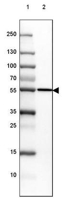 CYP21A2 Antibody in Western Blot (WB)