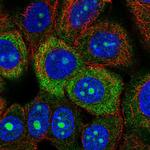 RPS3A Polyclonal Antibody