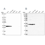 RPS3A Antibody in Western Blot (WB)