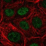 NUDT22 Polyclonal Antibody