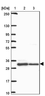 HFE Antibody in Western Blot (WB)