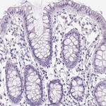 PDIA2 Antibody in Immunohistochemistry (Paraffin) (IHC (P))