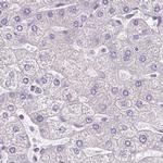 PDIA2 Antibody in Immunohistochemistry (Paraffin) (IHC (P))