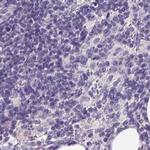 PDIA2 Antibody in Immunohistochemistry (Paraffin) (IHC (P))