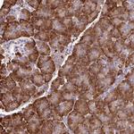 PDIA2 Antibody in Immunohistochemistry (Paraffin) (IHC (P))