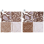 PCK2 Antibody in Immunohistochemistry (Paraffin) (IHC (P))